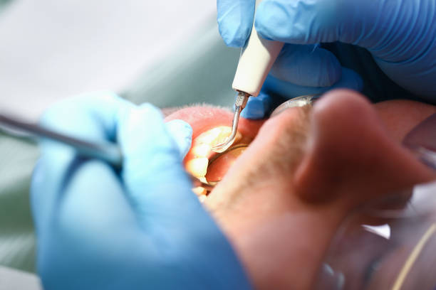 Best Emergency Dentist for Lost Fillings or Crowns in Crane, TX