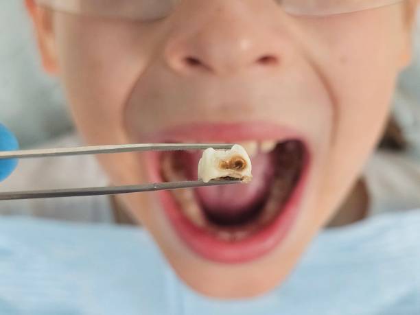 Best Pediatric Emergency Dentist in Crane, TX